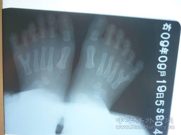 P1000414.JPG
