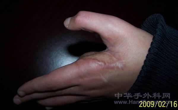 100_1650.jpg