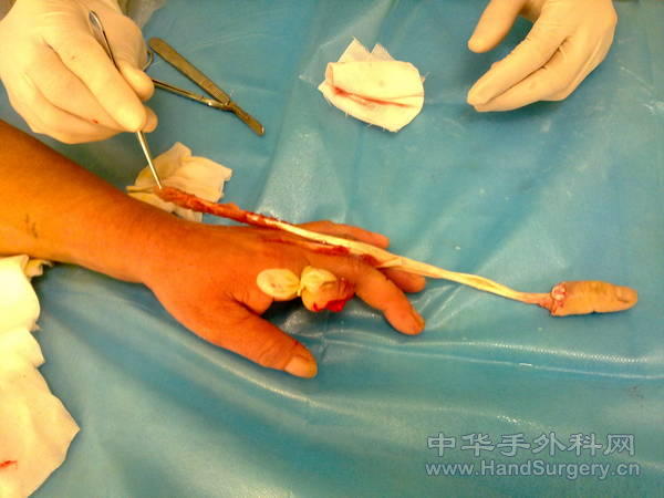 20110115319.jpg
