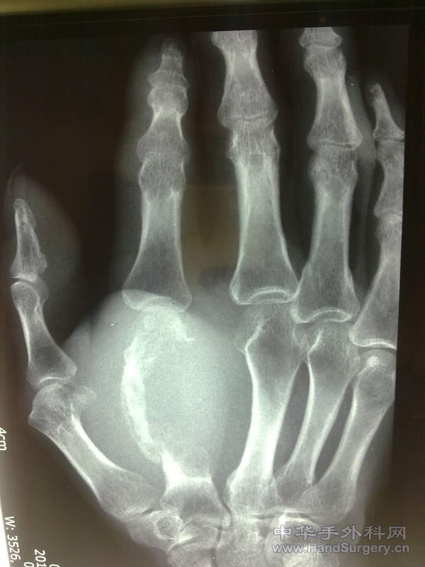 20110121057.jpg