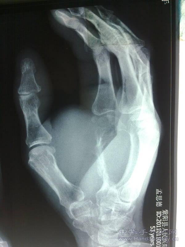 20110121058.jpg