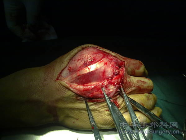 20110121061.jpg