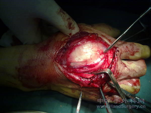 20110121065.jpg