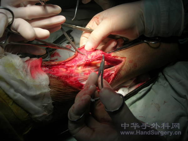 DSCN1518.JPG