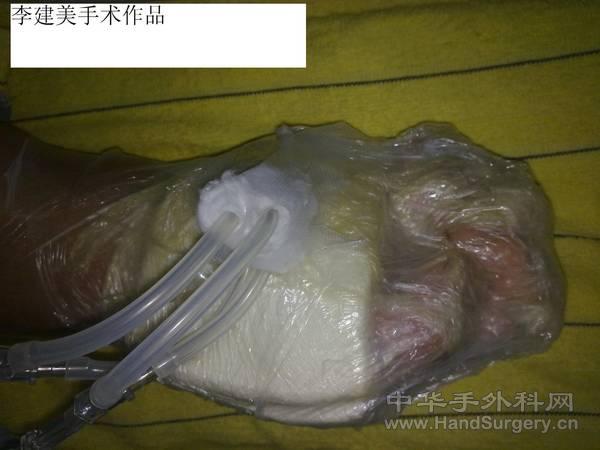 20110223095.jpg
