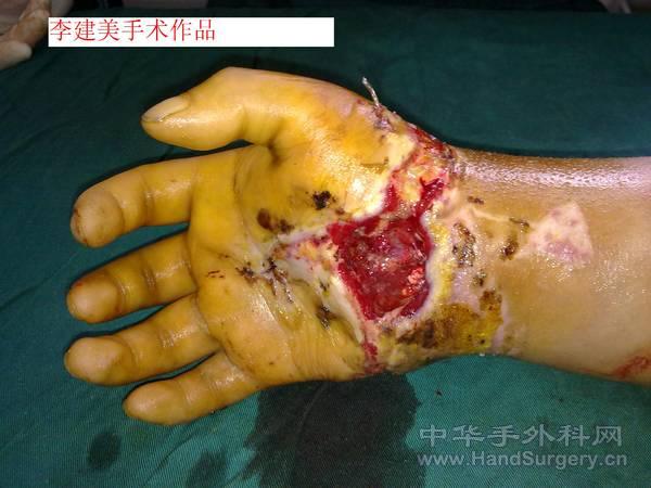 20110222093.jpg