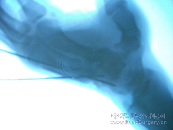 DSCF0850.JPG