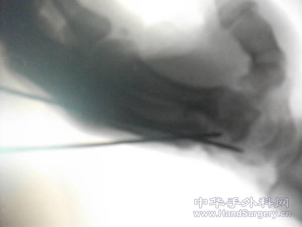 DSCF0851.JPG