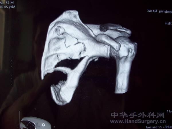 照片 056.jpg