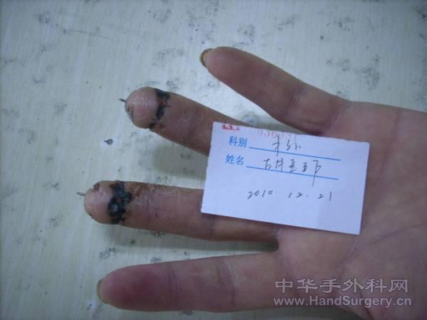 3.gif