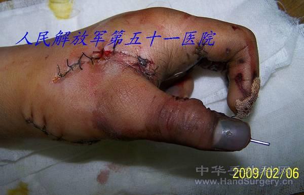 100_1588.jpg