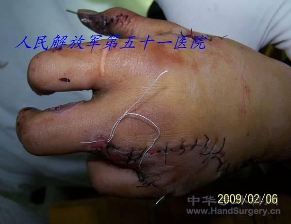 100_1590.jpg
