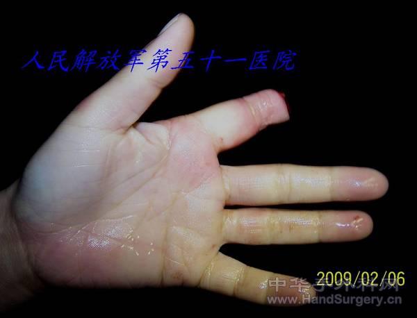 100_1578.jpg