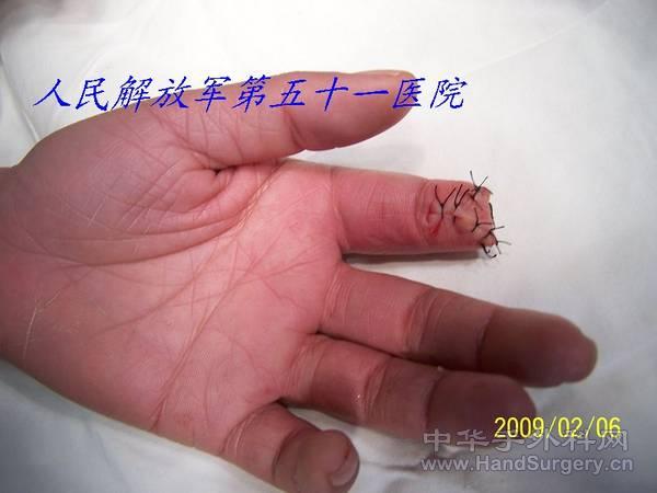 100_1580.JPG