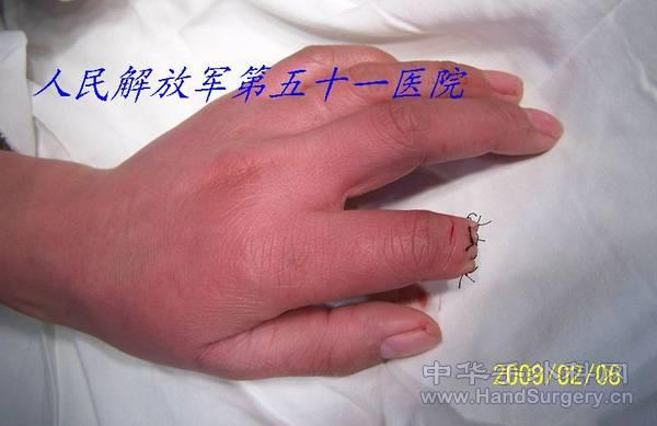100_1582.jpg