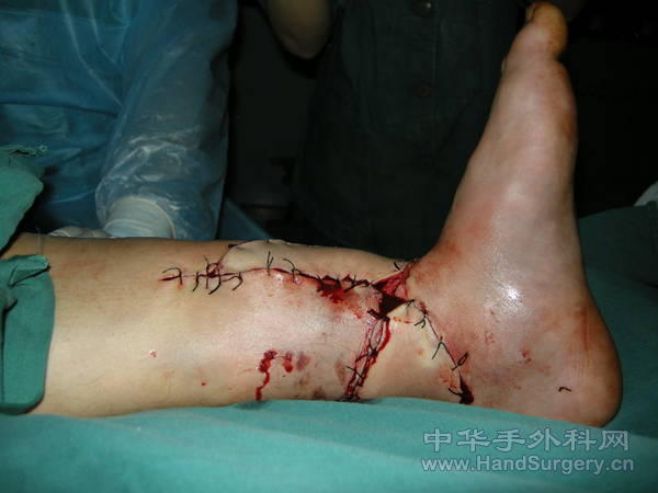 DSCN3817.JPG