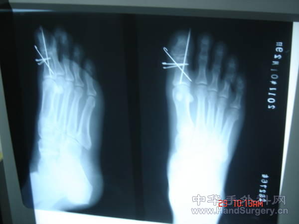 照片 011.jpg