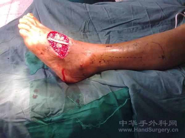 20100916580.jpg