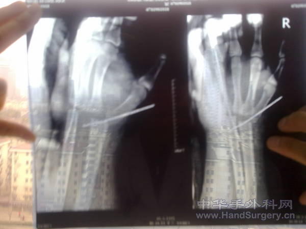 20110209071.jpg