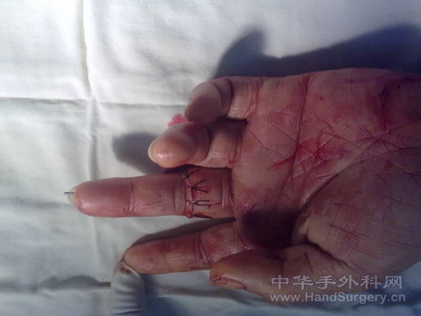 20100105034.jpg