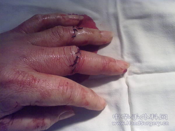 20100105035.jpg