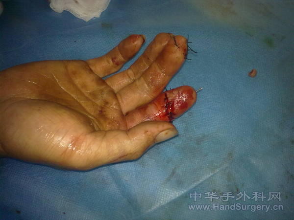 20100111046.jpg