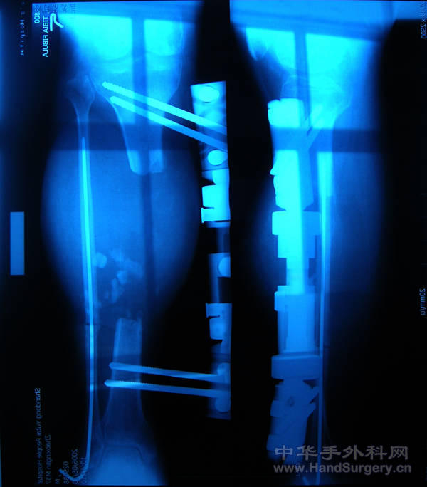 DSCN0632.JPG