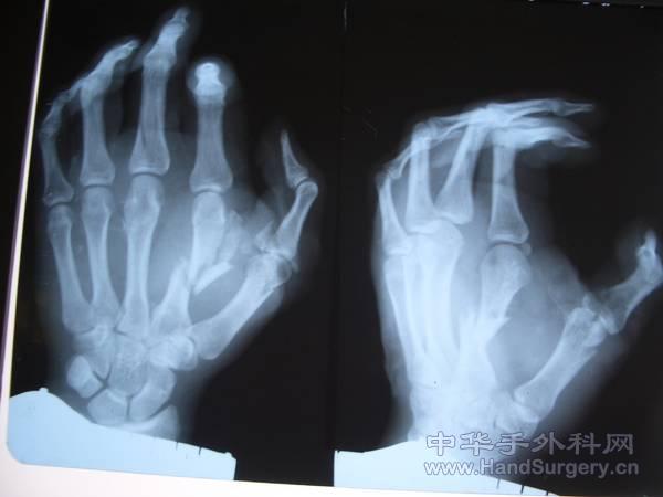 2011.03.11姚云枫 005.jpg
