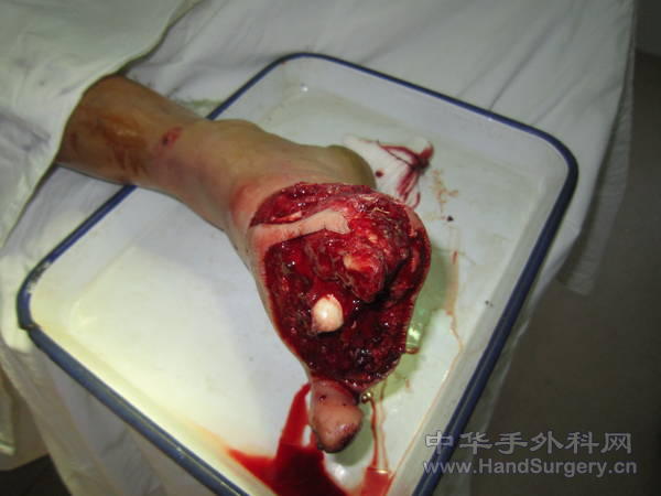 术前