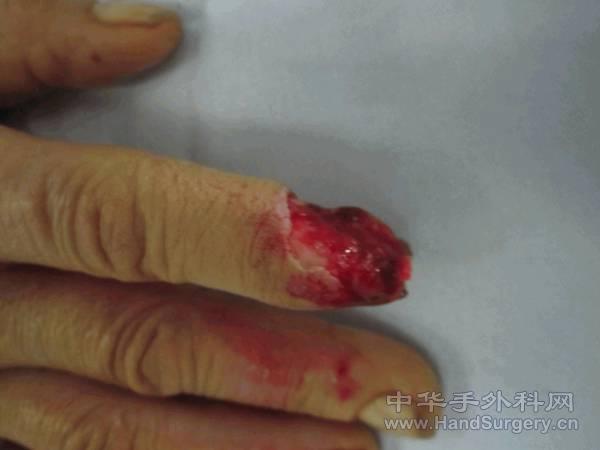图片2.gif
