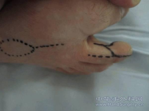 图片4.gif