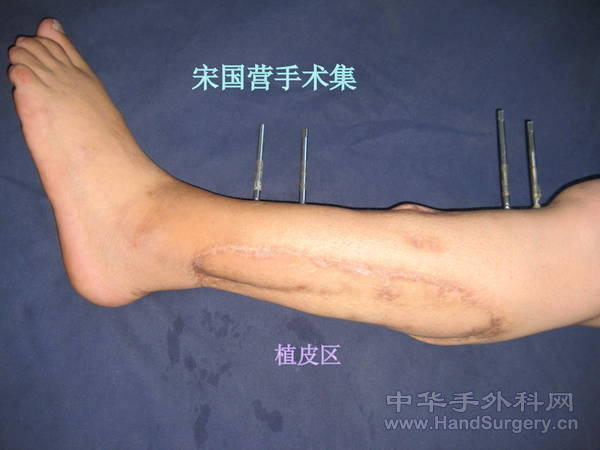 照片 014.jpg