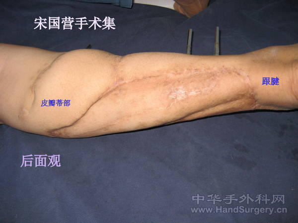 照片 015.jpg