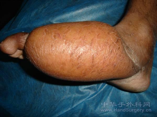 18.gif