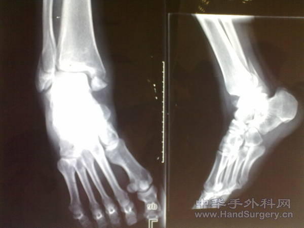 201103041258.jpg