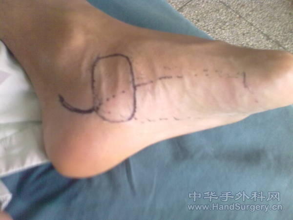 20101125857.jpg