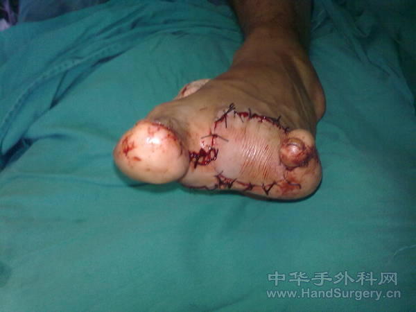 20101125864.jpg