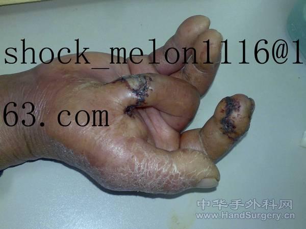 20101129116.jpg