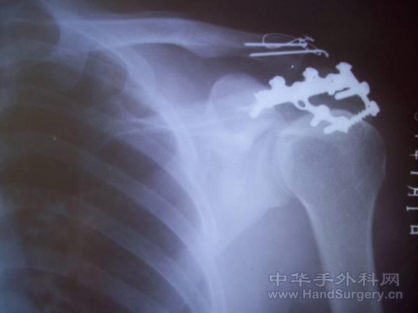 照片 095.jpg
