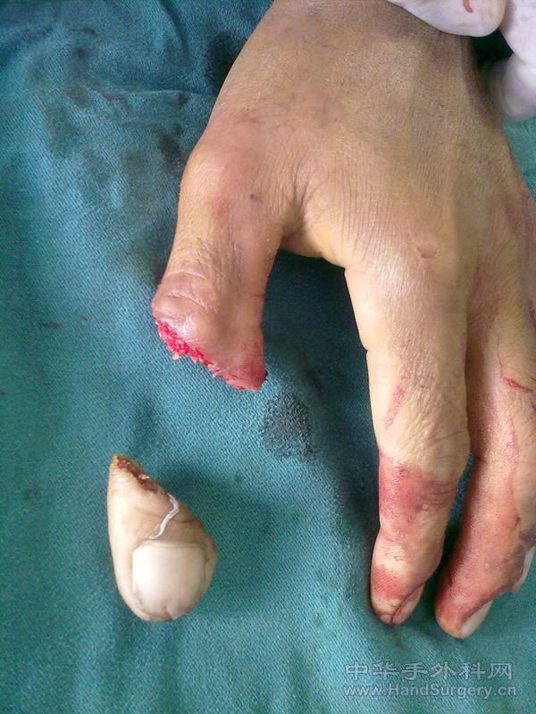 20101009706.jpg