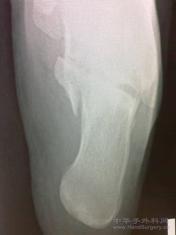 20101125852.jpg