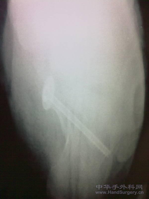 20101125855.jpg