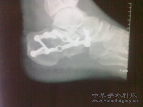 20101211954.jpg