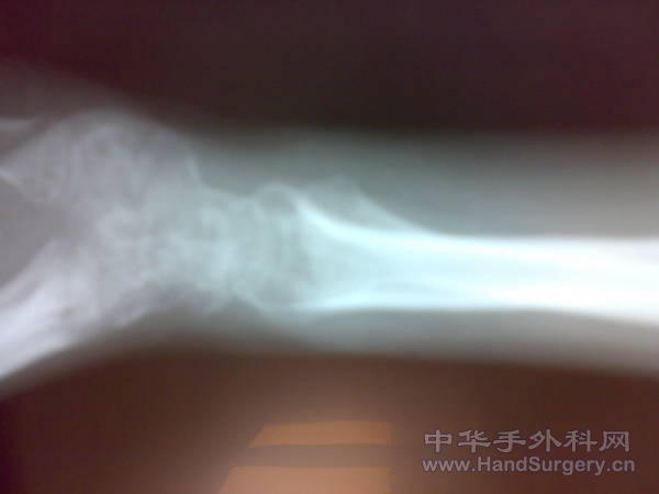 20110328249.jpg