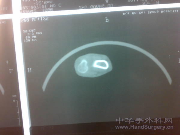 20110328250.jpg