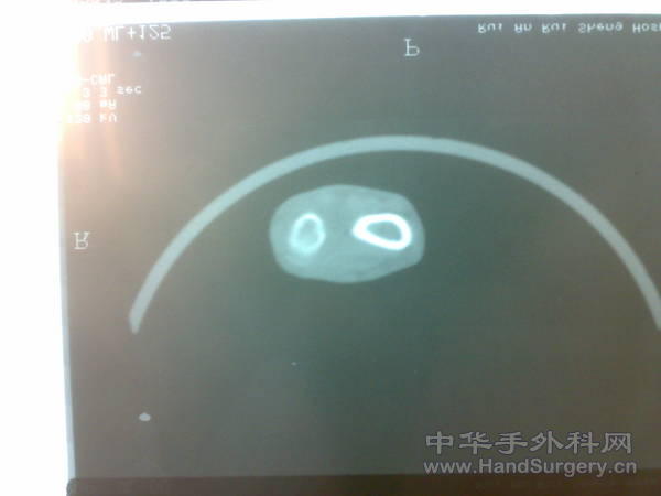 20110328251.jpg