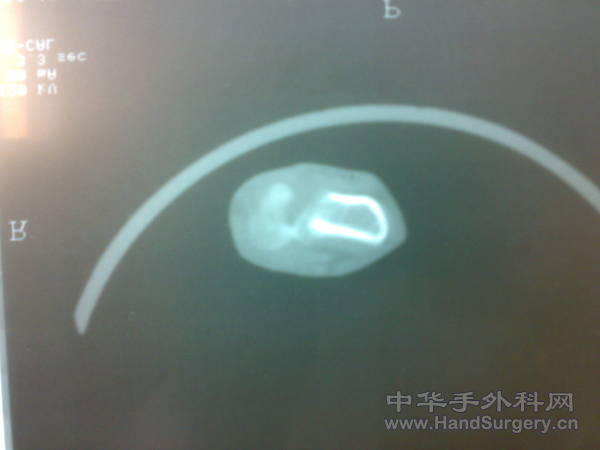 20110328252.jpg