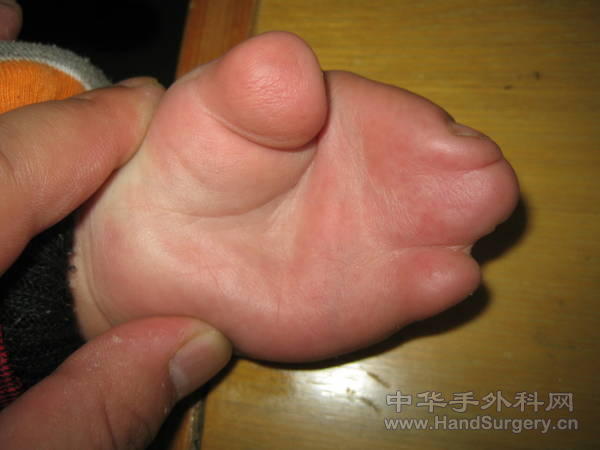 2011 125.jpg
