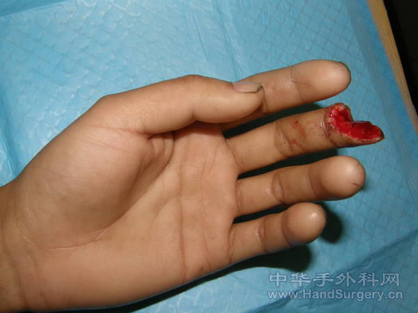 PB120125.JPG