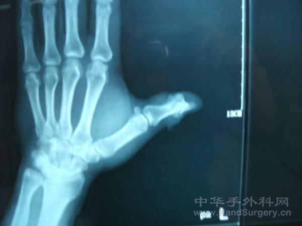 照片 083.jpg